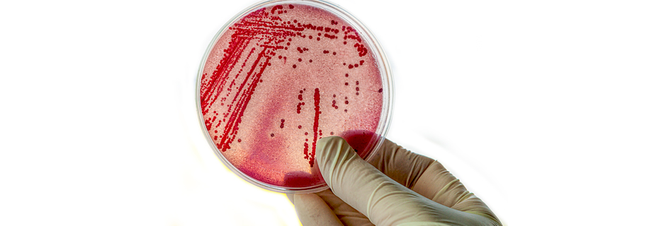 Bacteria