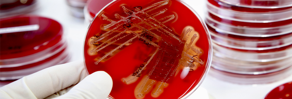 Bacteria